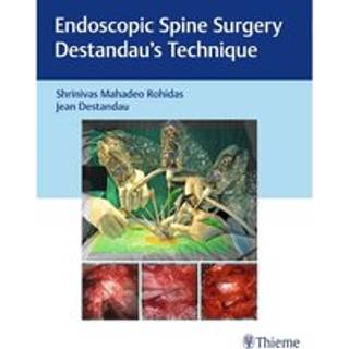 Endoscopic Spine Surgery