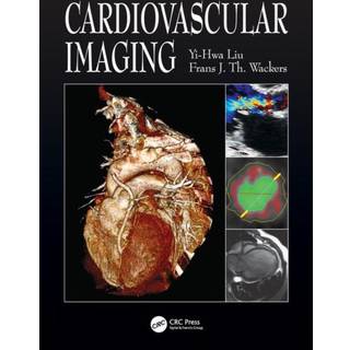 Cardiovascular Imaging