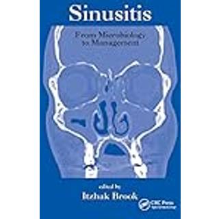 Sinusitis