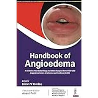 Handbook of Angioedema