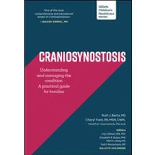 Craniosynostosis: Understanding and Managing the Condition