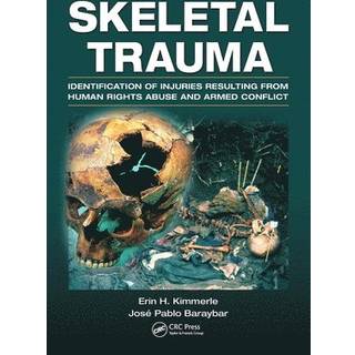 Skeletal Trauma