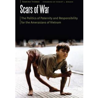 Scars of War