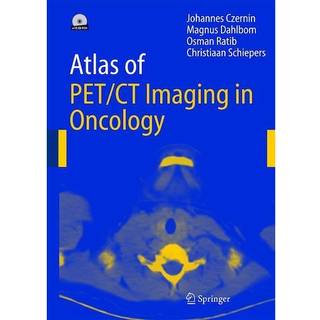 Atlas of PET/CT Imaging in Oncology