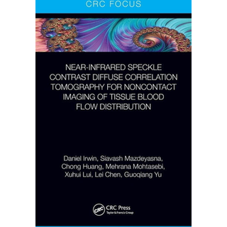Near-infrared Speckle Contrast Diffuse Correlation Tomography for Noncontact Imaging of Tissue Blood Flow Distribution
