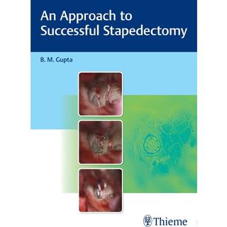 An Approach to Successful Stapedectomy