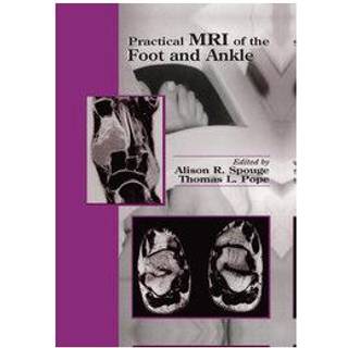 Practical MRI of the Foot and Ankle