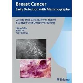 Casting-Type Calcifications: Sign of a Subtype with Deceptive Features