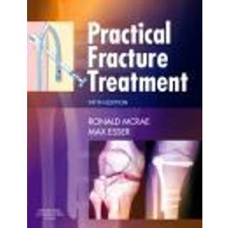 Practical Fracture Treatment