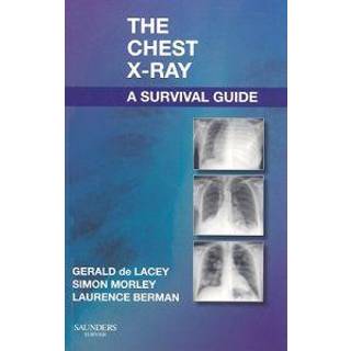 The Chest X-Ray: A Survival Guide