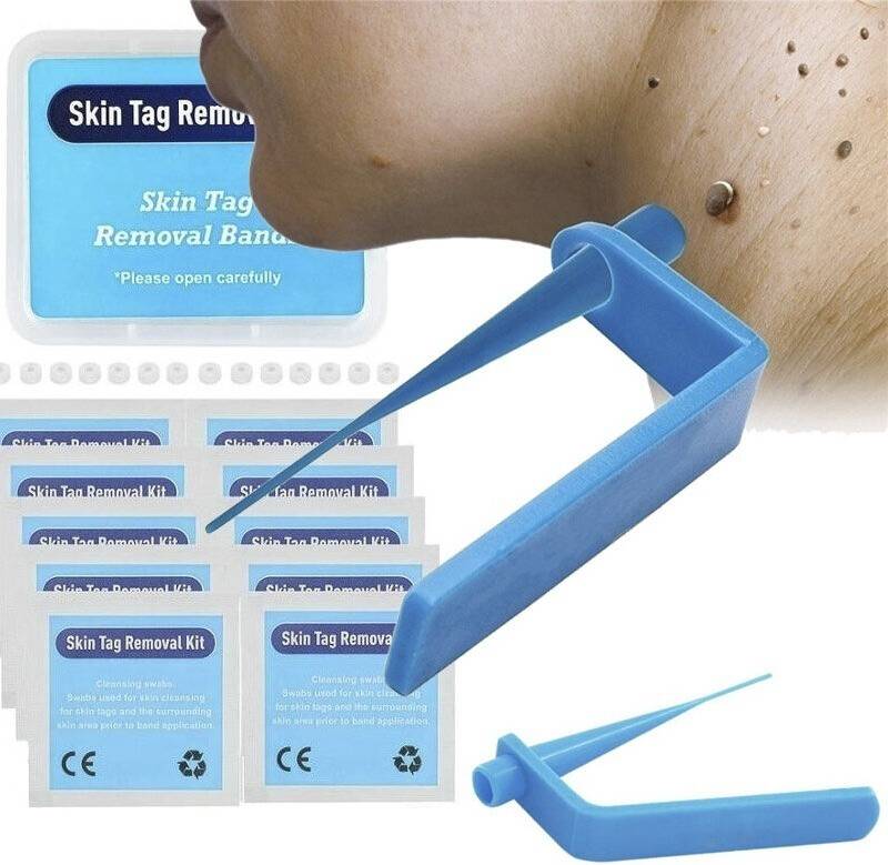 Skin tag removal kit Micro Skin Tag Remover Kit For Home Use
