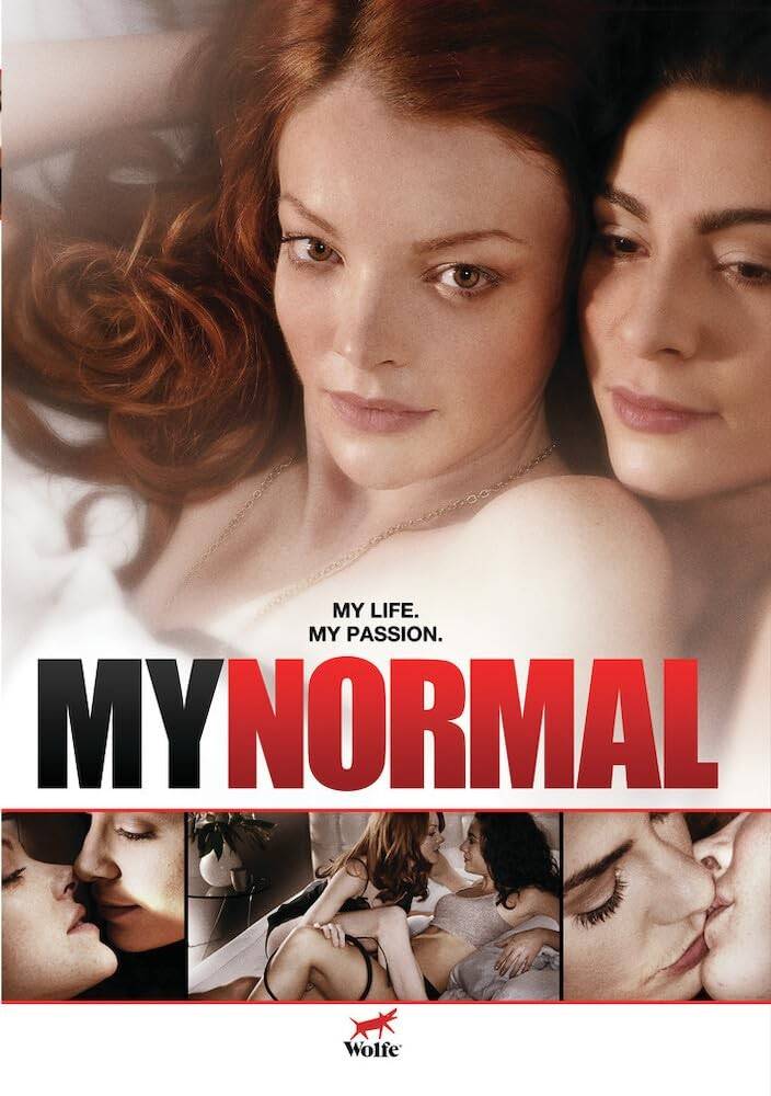 Normal My Normal DVD