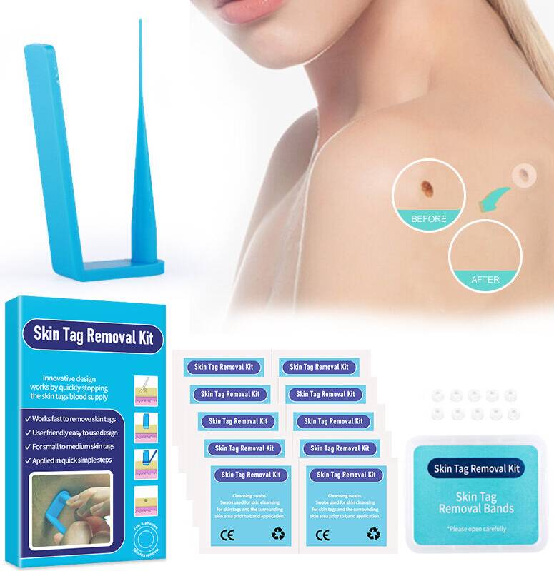 Skin tag removal kit Wejoy Mini Micro Skin Tag Removal Kit