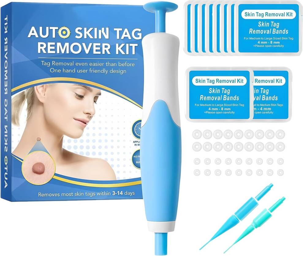 Skin tag removal kit Skin Tag Remover Kit