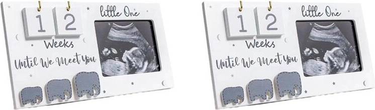 Photo frame Torribaly Baby First Scan Photo Frame