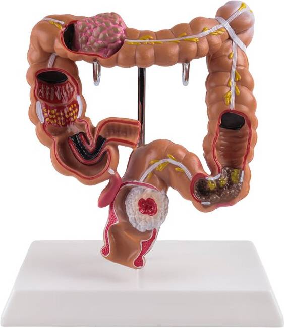 Typecat Human Large Intestine Digestive Model