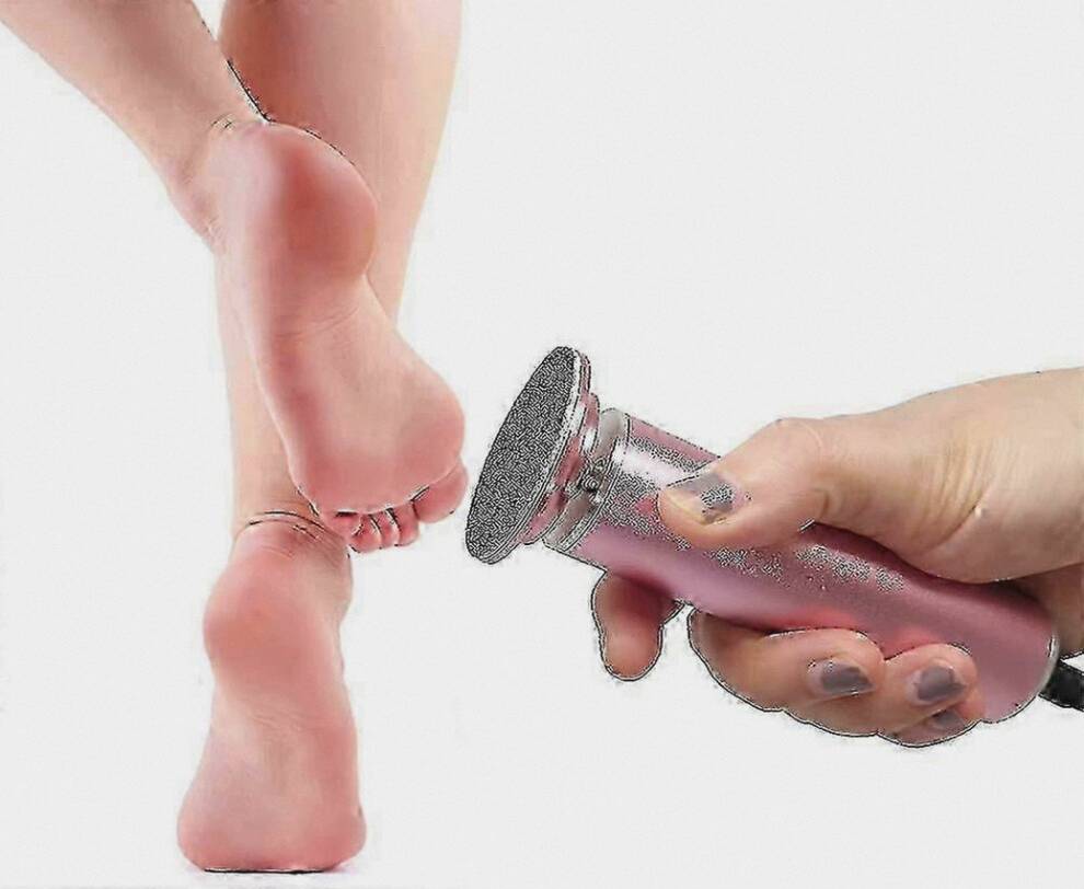 Electric Foot File for Calluses