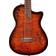 Cordoba Stage Nylon-String Electric Guitar