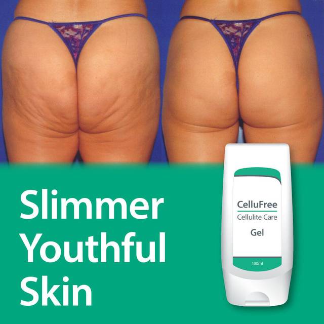 cellulite gel removes dimples lumps bumps smooth glowing skin