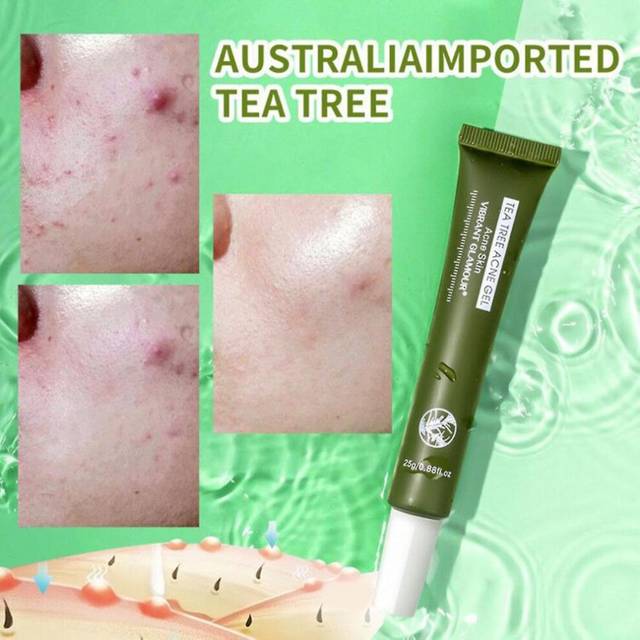 Vibrant Glamour Tea Tree Acne Gel 25g Acne Balance Water Oil Lightens Scar Spots