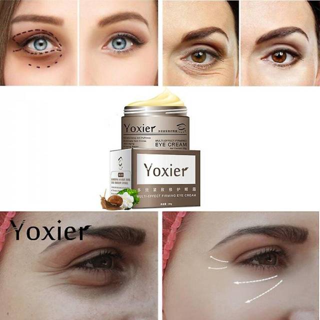 S Ct Eye Cream Re Removing Eye Bags Hydrat Eye Care Cream
