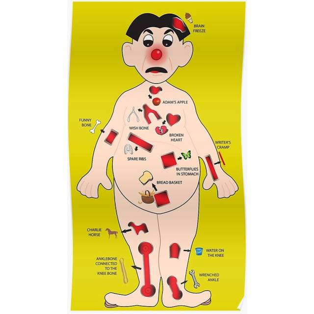 Posters OPERATION board game man - raise a smile for those in hospital 16x20 inch or 20x20 inch Wall Art Soccer Print