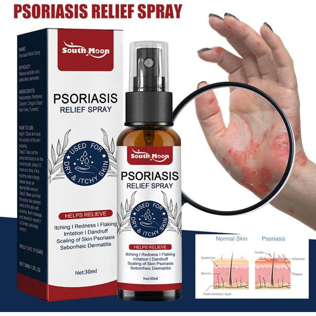 Psoriasis Relief Spray Herbal Essence Itching Treatment Ointment Skin