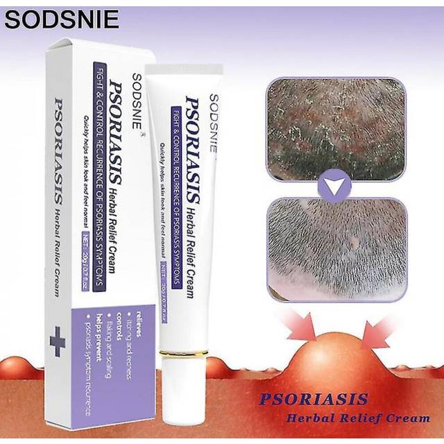 Psoriasis Herbal Relief Cream Nourish Anti-fungal Treatment Repair Strengthen Immunity Improve Scaly Redness Body Skin Care