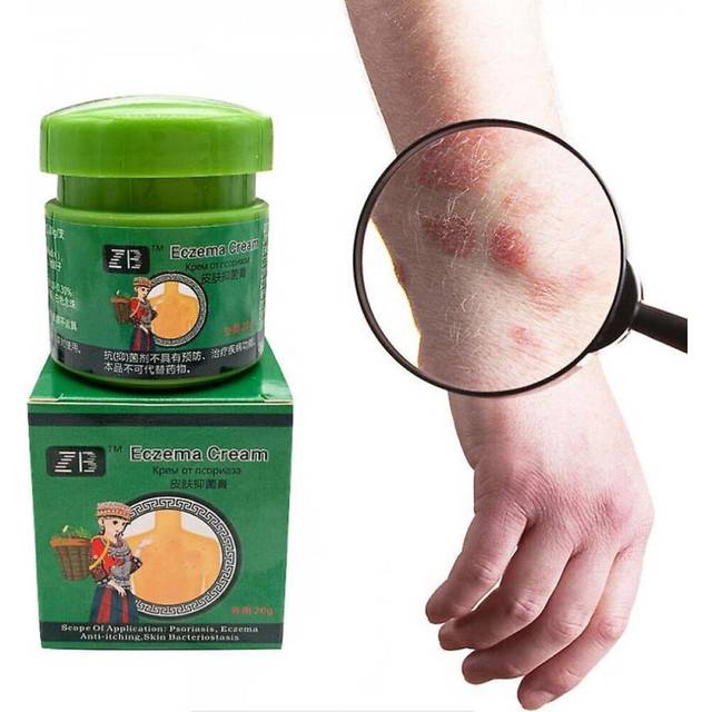 Miao Psoriasis Cream Anti-itch Antil Creams Relief Eczema Urtic For Pruritus Dermatitis