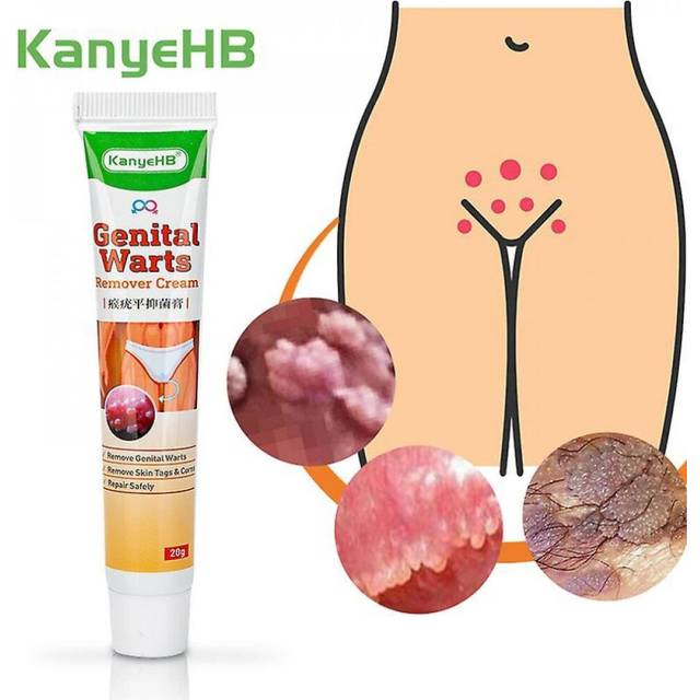 Warts Remover Antil Wart Cream Skin Tag Remover Plaster Warts