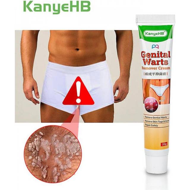 Skin Tag Remove Cream Wart Fast Removal Warts Papilloma Mole Rapidly Removes Moles Foot Cream