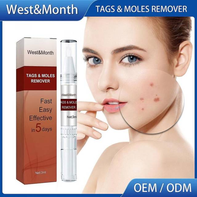 3ml Wart Remover Liquid Pen Ke Wart Pen Liquid Keyou Cream Excellent Flat Liquid