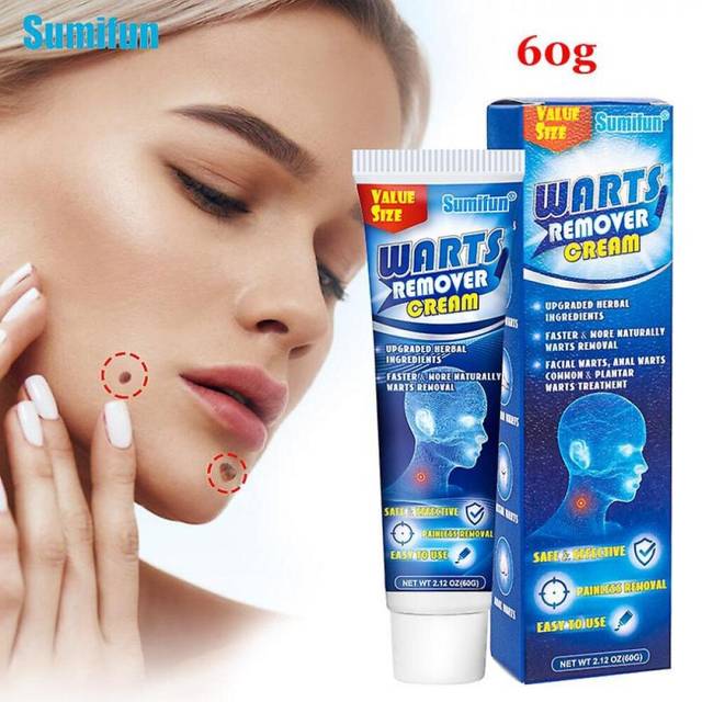 1box 60g New Wart Cream Treat Skin Tag Mole Antil Foot S Care Plaster