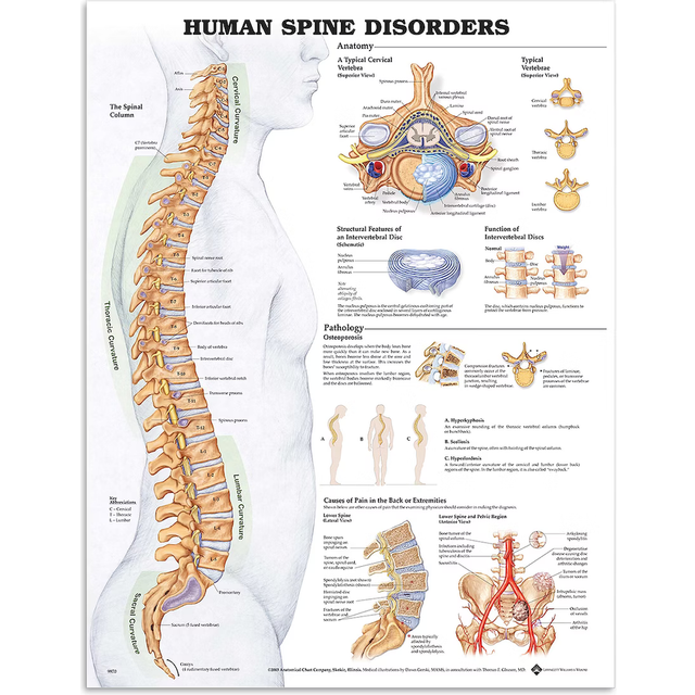 Human Spine Disorders Anatomical Chart