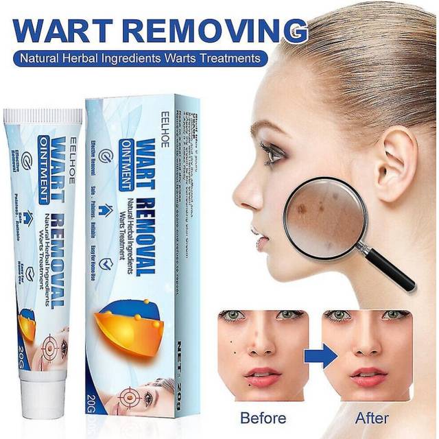 Huacreate Skin Tag Remover Cream Safe And Effective Skin Tag, Wart, Callus, Milia Remover Scar-free Cream For Men Women