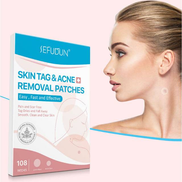 Skin Tag Remover Skin Tag Remover Flat Warts Facial Warts
