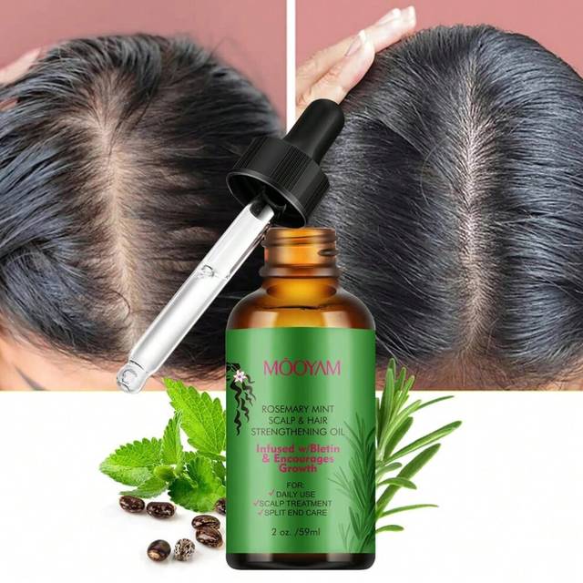 (1PCS) Organic Rosemary Mint Scalp & Hair Strengthening Oil With Biotin & Essential Oils,Multipurpose Rosemary Oil